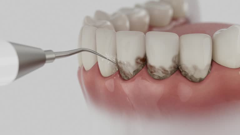 Trusted Teeth Cleaning And Checkup service in Brownville, NJ - Dentist Open Now